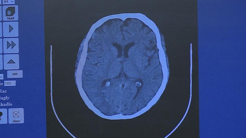 Wejherowska neurologia z diamentowym statusem